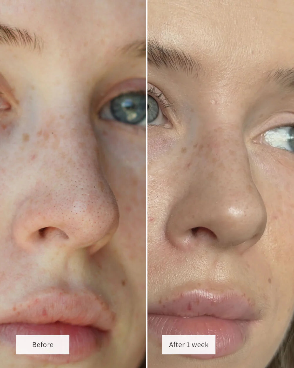 NOSE PATCHES 8 Patches Per Box